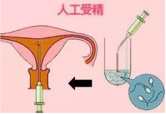 探访鱼儿人工授精作文450字