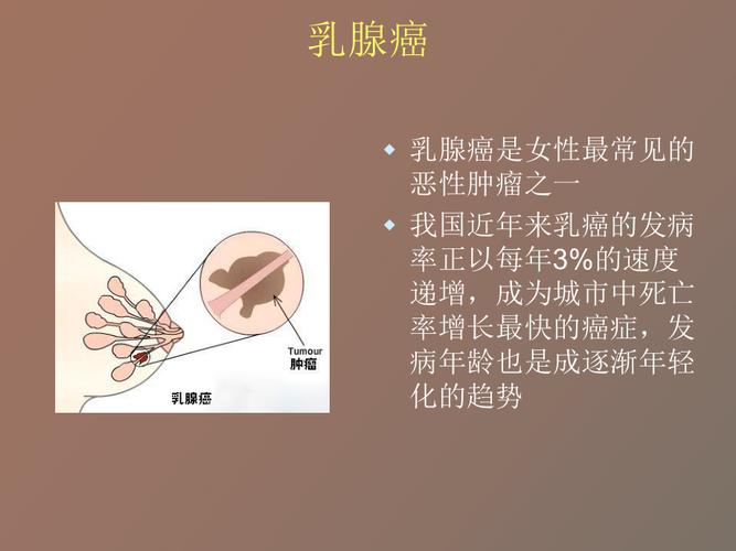 英国发明能检测乳癌的“智能胸罩”